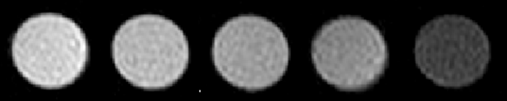 MRI造影剂T2弛豫时间及T2加权成像